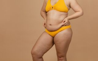 Une femme avec des excès de graisse