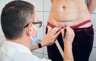 La préparation d'une opération de liposuccion