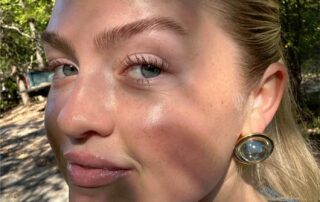 corriger complexe medecine esthetique