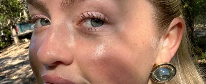 corriger complexe medecine esthetique