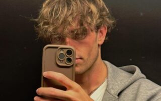 greffe cheveux homme