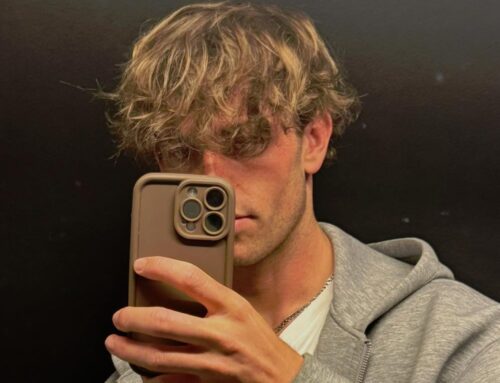 Greffe de cheveux : naturelle ou visible ? Ce que les résultats disent vraiment