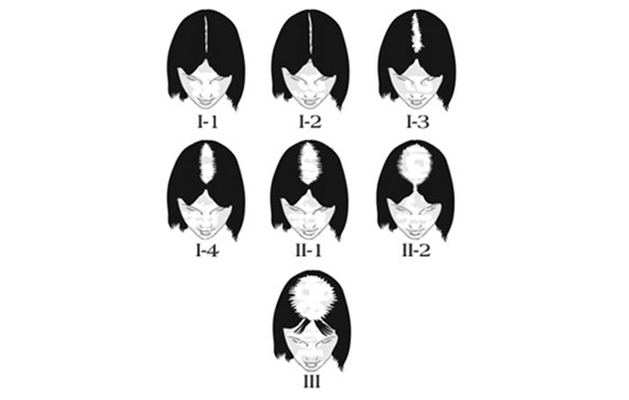 plan de traitement cheveux femme